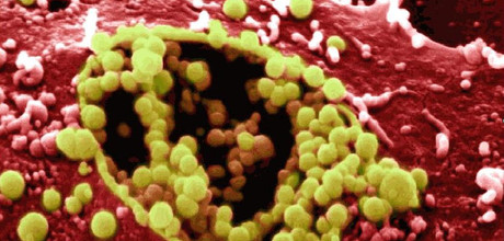 Berstende Zelle (rot) , die Chlamydien (gelb) freisetzt