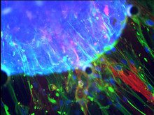 "organoider Gewebekörper" (blau), differenzierte Nerven- (grün) und Muskelzellen (rot)