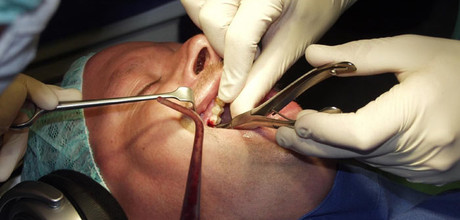 Kieferchirurgische Operation unter Hypnose. Gut sichtbar: Der Patient trägt einen Kopfhörer, über den er die Hypnose-CD hört